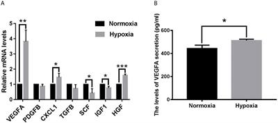 Artesunate Suppresses Choroidal Melanoma Vasculogenic Mimicry Formation and Angiogenesis via the Wnt/CaMKII Signaling Axis